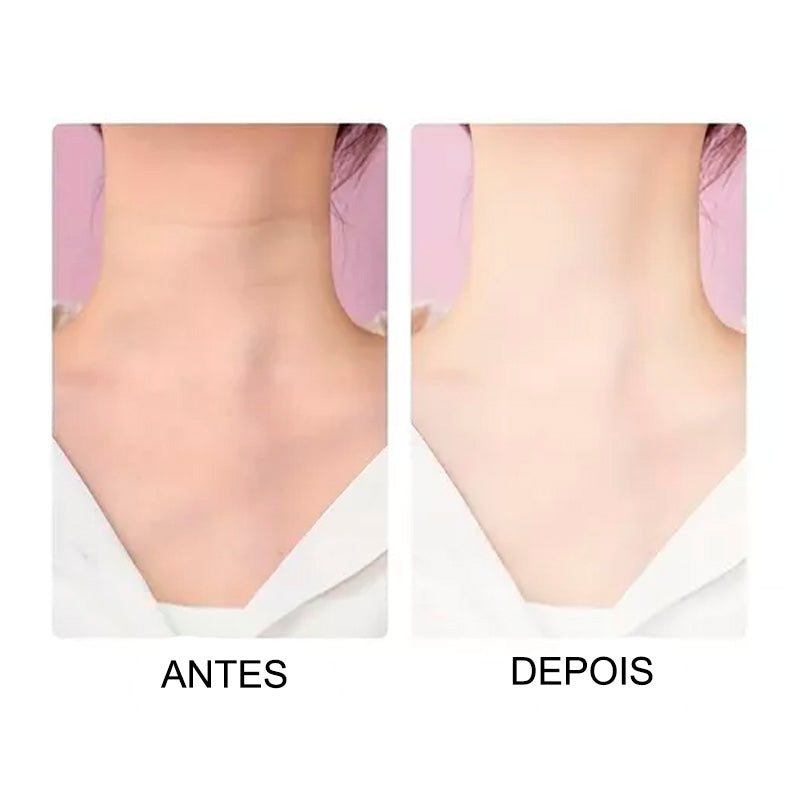 MASSAGEADOR DE PESCOÇO E ROSTO - REJUVENESCIMENTO FACIAL E REMOÇÃO DE PAPADA